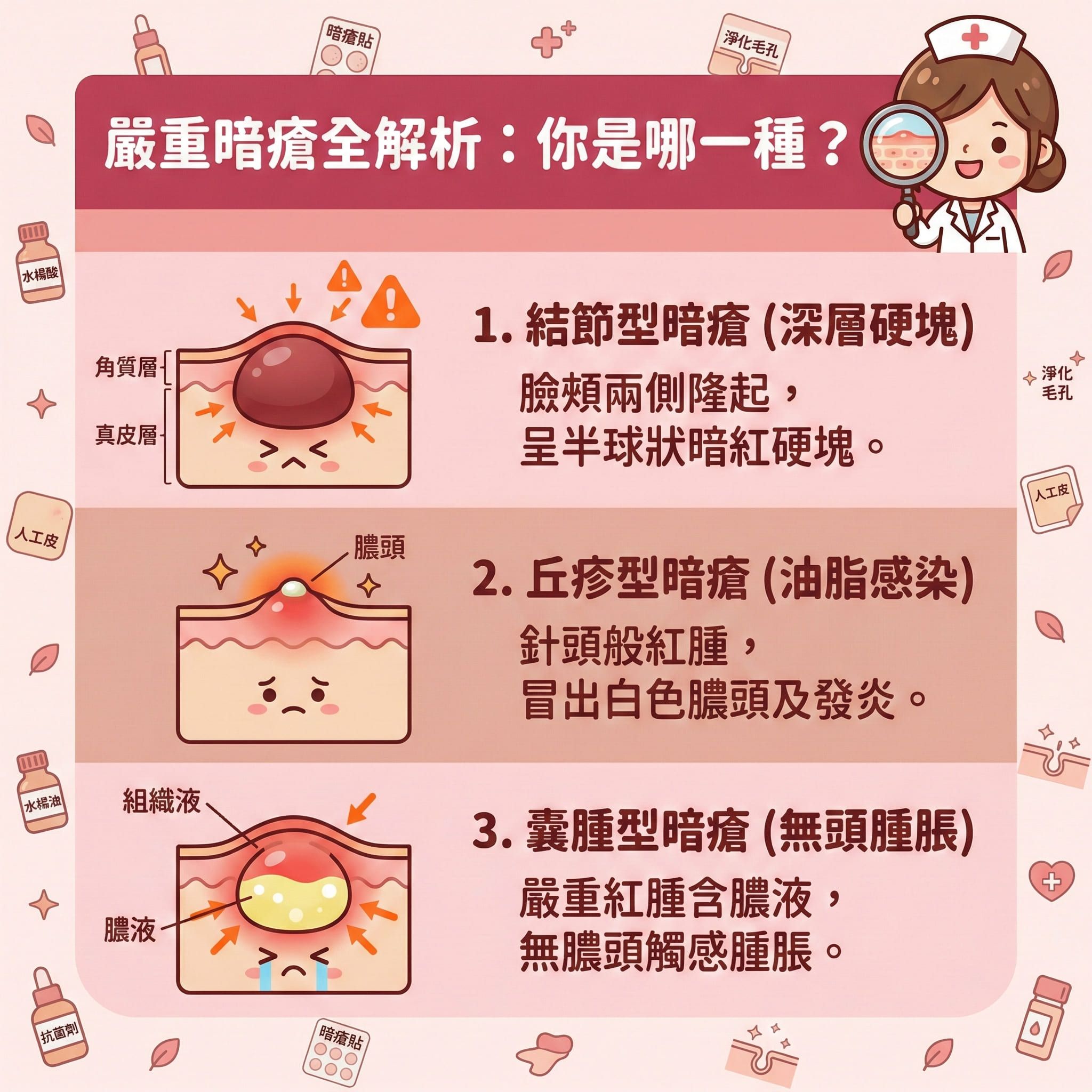 這是一張正方形的扁平化向量醫美資訊圖表,背景採用粉嫩色調,詳細解構三種嚴重暗瘡類型。圖中展示皮膚的角質層及真皮層結構,第一種是類似石頭瘡的結節型;第二種是受細菌感染、帶有膿頭的丘疹;第三種是充滿組織液與膿液的囊腫型暗瘡,這類暗瘡多由粉刺與黑頭惡化而成。
圖表建議日常護理需淨化毛孔、促進代謝及軟化角質。發炎期間可使用含水楊酸、茶樹油或抗菌劑等成分的暗瘡貼或人工皮,具備透氣防水及隱形貼服特性,非常適合妝前使用。只要定時更換,就能吸收分泌物與吸走膿液,達致消炎殺菌。這層保護能隔離細菌及隔絕污染物,發揮保護傷口與預防感染的作用,並防止擠壓。這樣不僅能舒緩鎮靜、改善紅腫及撫平紅腫,更能加速癒合並避免留疤,防止日後形成暗瘡印及凹凸洞。若情況嚴重,建議尋求完美醫療等專業機構幫助處理深層傷口。