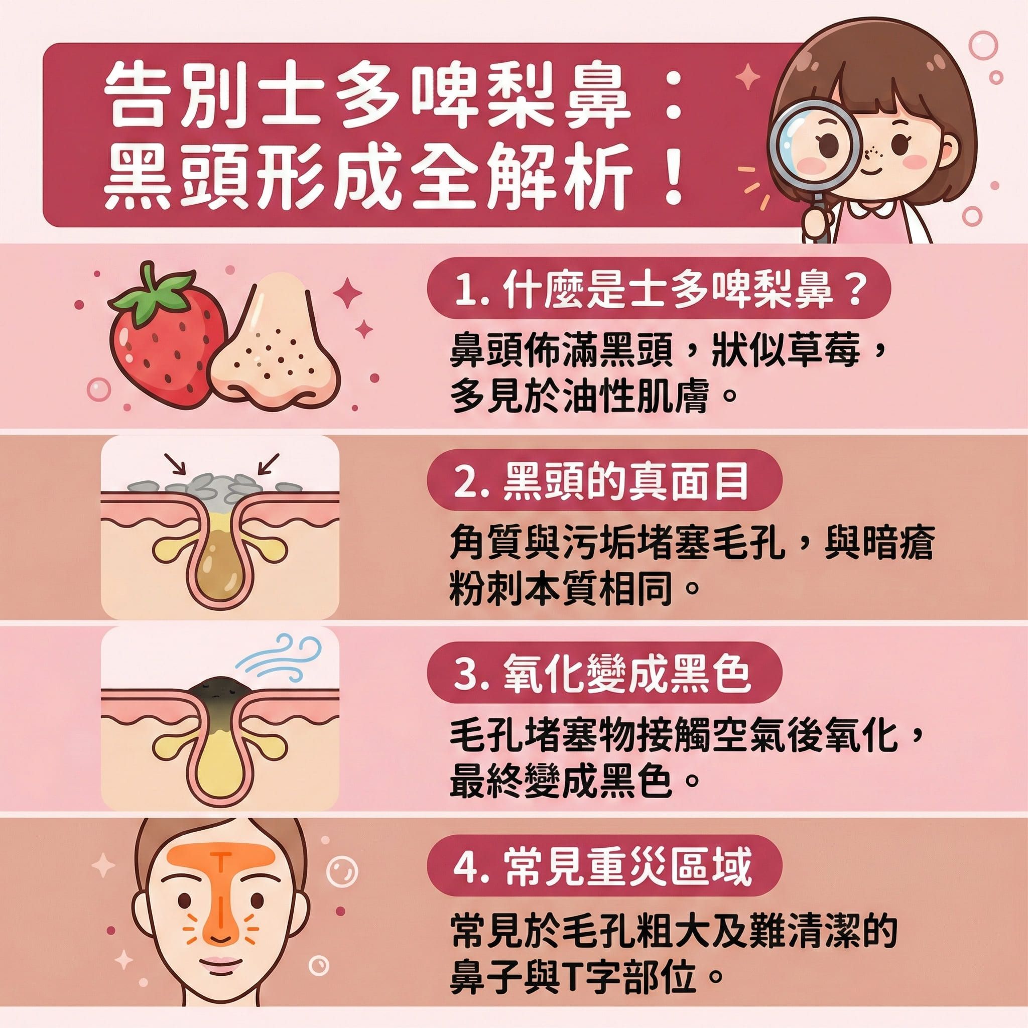 這是一張正方形扁平化醫美資訊圖表,主題為解析士多啤梨鼻的成因與改善方法。圖表中展示了面部T字部位及鼻頭的皮膚剖面,顯示皮脂腺受荷爾蒙影響分泌過多油脂,混合死皮與角質層污垢後堵塞毛孔。當這些混合物接觸空氣氧化,便會形成黑頭,若受痤瘡桿菌感染則會演變成粉刺與暗瘡。圖表特別提醒,這與微絲血管擴張引發的酒糟鼻及玫瑰痤瘡不同,需仔細辨別。
圖表下方建議日常需注重水油平衡與徹底卸妝,可使用適合的卸妝油來清除污垢及進行深層清潔。護理上應避免擠壓,以免傷害皮膚及微絲血管。建議定期使用果酸或水楊酸來溫和去角質及軟化角質細胞,有效去除老廢角質,達到導出黑頭與溶解黑頭的功效。這樣不僅能疏通毛孔、預防毛孔堵塞,更能抑制油脂分泌及收細毛孔。
針對嚴重情況,圖表建議可透過專業醫美如完美醫療的暗瘡分手療程,療程能有效消炎殺菌、舒緩紅腫,同時促進新陳代謝並刺激膠原增生。這有助於改善粗糙膚質,達到預防復發的長效目的。