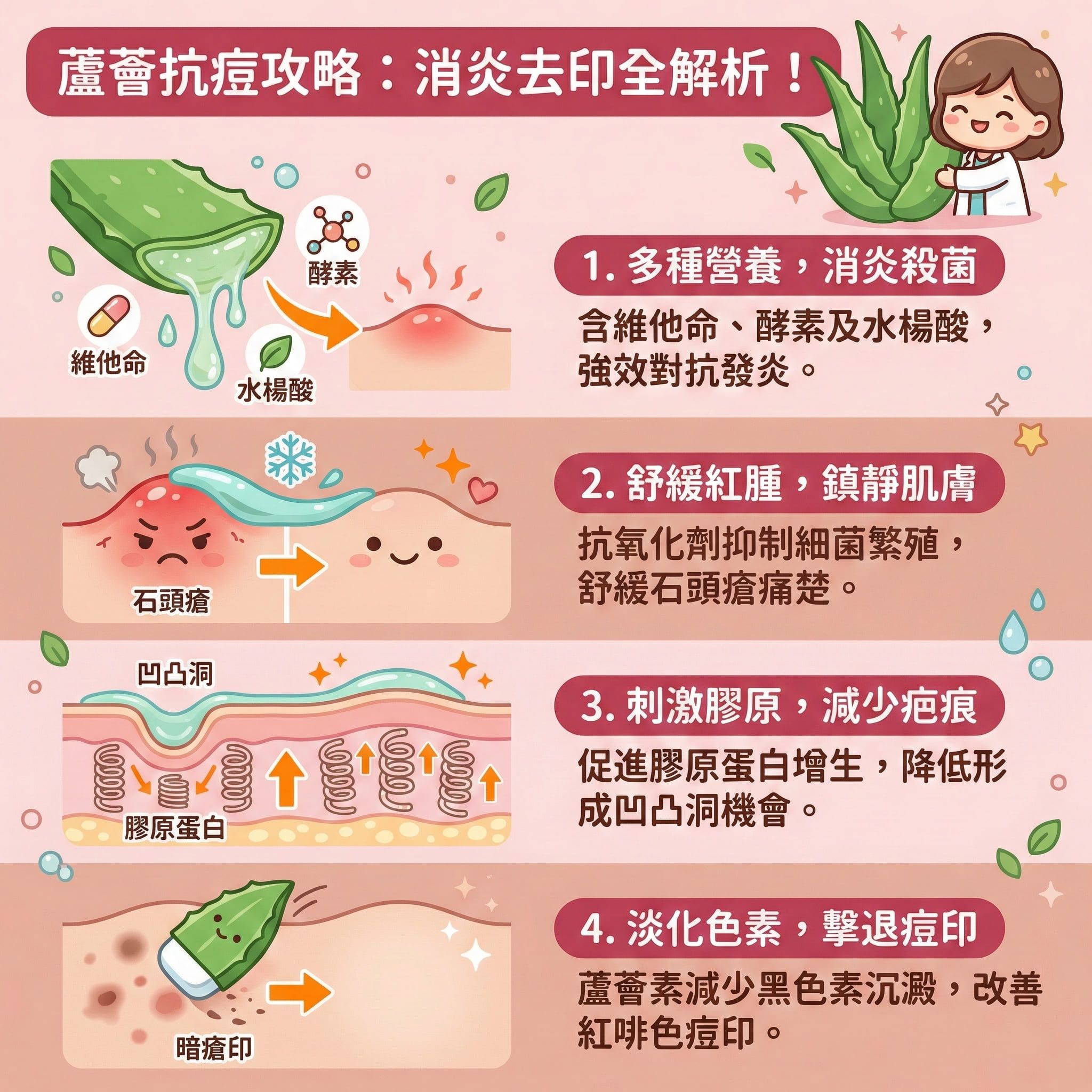 這是一張正方形的扁平化向量醫美資訊圖表,背景採用柔和粉嫩色調,詳細說明天然成分蘆薈改善暗瘡的機制。圖表上方標題為「蘆薈抗痘攻略」。
圖中左側的插圖展示了皮膚結構,包括角質層、真皮層和皮脂腺。說明當皮脂腺分泌過多油脂堵塞毛孔,會形成粉刺,並滋生痤瘡桿菌引發發炎,導致石頭瘡。
右側的插圖展示了塗抹蘆薈凝膠後的效果。圖中強調蘆薈富含維他命、氨基酸、酵素和水楊酸等成分,能發揮強大的消炎殺菌作用,抑制油脂分泌並進行深層清潔。視覺上顯示蘆薈能舒緩紅腫,減輕痛楚,為敏感肌帶來溫和無痛的鎮靜肌膚效果。
下方圖示進一步說明蘆薈能刺激增生,促進膠原蛋白合成,幫助修復屏障和促進癒合,從而減少凹凸洞和暗瘡印的形成,並有效淡化色素。雖然圖中未直接繪製茶樹油,但蘆薈同樣具備水油平衡、收細毛孔及軟化角質的能力。整體強調其抗氧化和曬後修復特性,有助預防復發和減少摩擦。對於尋求更進一步治療的人士,圖中暗示了如完美醫療的暗瘡分手療程