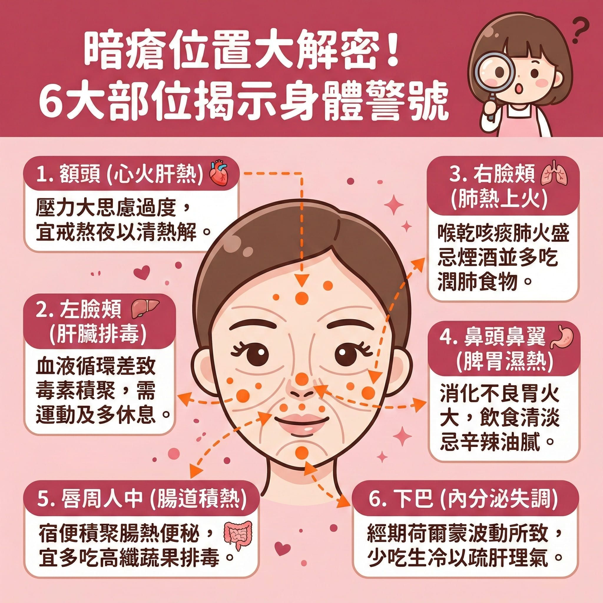 這是一張正方形的可愛扁平化醫美資訊圖表,深入分析不同的暗瘡位置反映的身體狀況。圖表中央有一個人臉地圖,標示了各個重點部位。
當額頭、太陽穴及髮際線長痘,通常反映心火盛與肝熱,需舒緩壓力、避免熬夜、改善睡眠質素與調節生理時鐘來清熱解毒。左臉頰長痘代表肝臟排毒不佳,需促進血液循環及提升排毒機能;而右臉頰則反映肺熱。
若鼻頭與鼻翼長痘,代表脾胃不佳,需改善腸胃濕熱及保持飲食清淡。唇周長痘顯示腸熱便秘,需調理五臟。最常見的下巴痘痘,則與內分泌及荷爾蒙失調有關,需調理內分泌及疏肝理氣。
除了內在調理,外在護理同樣重要。活躍的皮脂腺會分泌過多油脂,導致毛孔堵塞。我們應注重深層清潔與溫和去角質來疏通毛孔及預防毛孔堵塞,達致水油平衡、抑制油脂分泌與減少皮脂分泌。若已經發炎,需做好消炎殺菌。為了徹底解決肌膚煩惱,圖表強烈推薦完美醫療的專業暗瘡分手療程,由內到外重拾健康平滑肌膚。