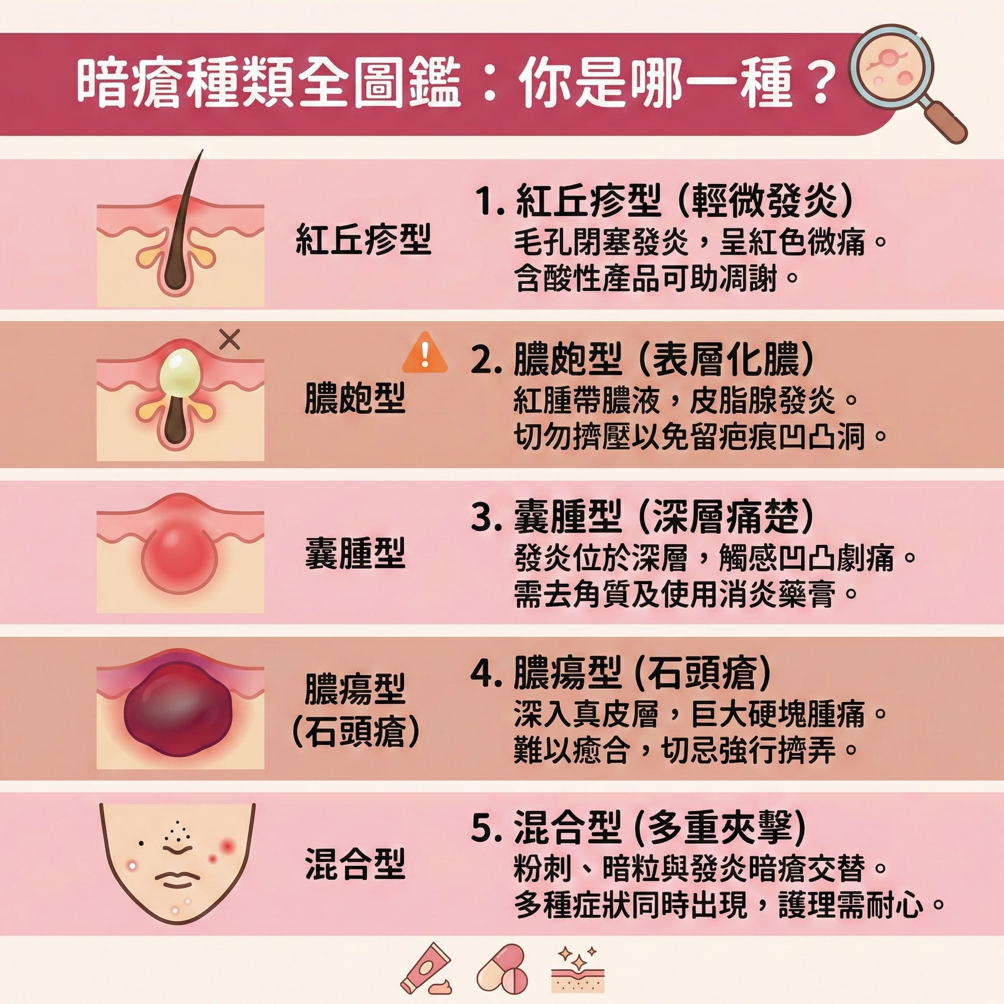 這是一張正方形的扁平化向量醫美資訊圖表,背景使用柔和粉色調,主題為「暗瘡種類全圖鑑」。
圖表由上至下分為五個區塊,詳細解析不同暗瘡 (Acne) 類型。
顯示紅丘疹型,說明油脂分泌過多導致毛孔堵塞與皮脂腺 (Sebaceous Glands) 發炎,建議徹底清潔及水油平衡。
展示膿瘡 (Pustules) 與黑頭粉刺 (Blackheads / Comedones),強調細菌感染與痤瘡桿菌 (P. acnes) 造成發炎紅腫。圖示警告避免擠壓以預防疤痕及淡化痘印。
描繪囊腫型與石頭瘡 (Cystic Acne),發炎深入角質層 (Stratum Corneum),指出荷爾蒙 (Hormones) 與紓緩生活壓力的重要性。建議使用水楊酸 (Salicylic Acid / BHA)、果酸 (AHA) 或茶樹油 (Tea Tree Oil) 幫助去除老廢角質。
介紹嚴重的膿瘍型,圖示建議醫療級換膚或激光治療 (Laser Treatment) 來抑制黑色素、刺激膠原增生 (膠原蛋白 (Collagen)) 及舒緩鎮靜。
提及混合型,建議專業皮膚分析與敏感肌膚護理。
圖表周圍裝飾包含治療元素如暗瘡貼 (Acne Patch) 用於吸收分泌物與加速傷口癒合,以及視黃醇 (Retinol)、異維A酸 (Isotretinoin / A酸)、抗生素 (Antibiotics) 與類固醇 (Steroids) 等藥物圖示。底部文字提醒注意紫外線 (UV Rays) 防護,調整飲食習慣,並推薦完美醫療 (Perfect Medical) 的專業協助。