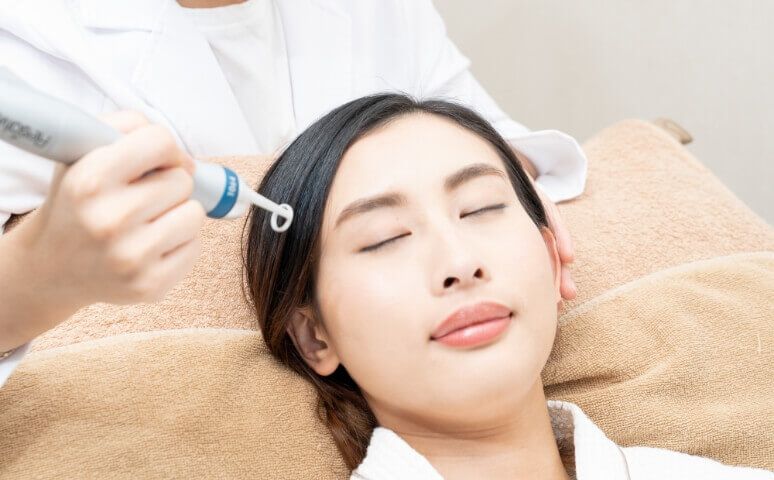 进行 RGA 爆发疗程 